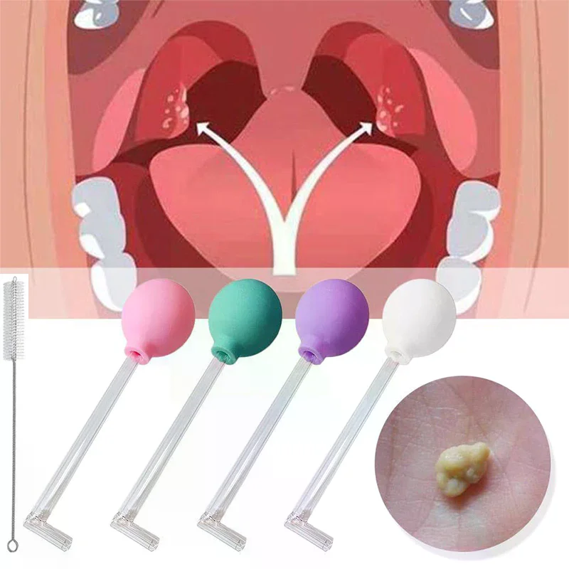 Steenverwijderaar Gereedschap  - Ear Wax Remover recensie en prijs