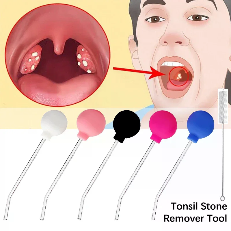 Steenverwijderaar Gereedschap  - Ear Wax Remover recensie en prijs