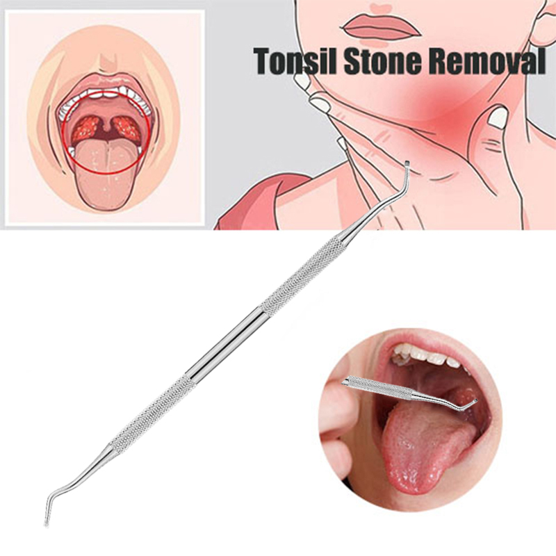 1 Stuk Tonsil Steenverwijderin - Ear Wax Remover recensie en prijs
